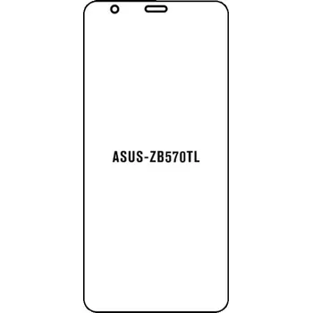 engaroGuard Hydrogel - ochranná fólie - ASUS ZenFone Max Plus (M1) ZB570TL průsvitná nepoužívám kryt = folie na celý displej 1 kus s výřezem přední kamery