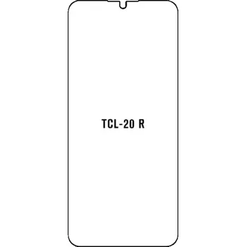 engaroGuard Hydrogel - ochranná fólie - TCL 20 R 5G průsvitná nepoužívám kryt = folie na celý displej 1 kus s výřezem přední kamery