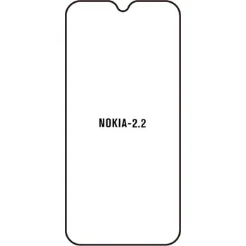 engaroGuard Hydrogel - ochranná fólie - Nokia 2.2 průsvitná nepoužívám kryt = folie na celý displej 1 kus s výřezem přední kamery