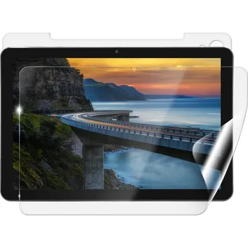 Fólie pro tablet Screenshield IGET Smart W30 fólie na celé tělo IGT-SMW30-B