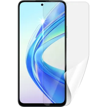 Screenshield HUAWEI Honor X7b fólie na displej HUA-HONX7B-D