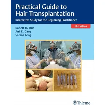Practical Guide to Hair Transplantation (EN)