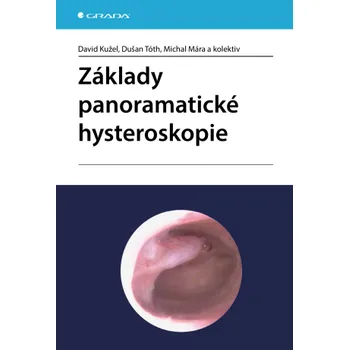 Kniha Základy panoramatické hysteroskopie - David Kužel, Tóth Dušan, Michal Mára