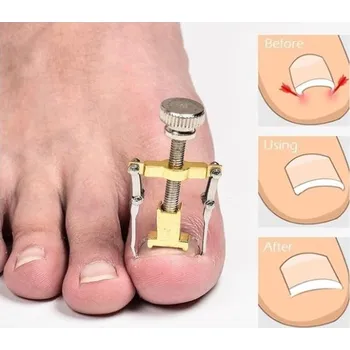 ZdravyNákup - Proti zarůstání nehtů na nohou