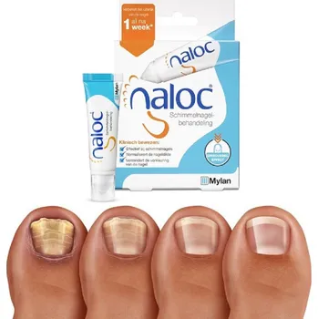 Pleťový krém Intenzivní lokální péče při nehtové mykóze a psoriáze NALOC, 10ml