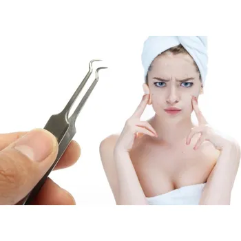 Péče o řasy a obočí Pinzeta na čištění pórů, vytlačování a odstraňování akné, černých teček z pleti
