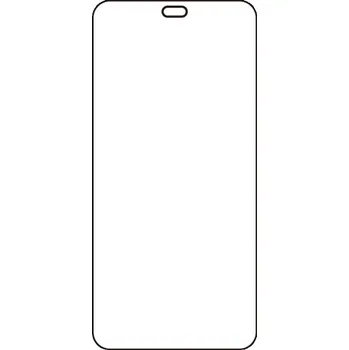 engaroGuard Hydrogel - ochranná fólie - Honor 400 lite průsvitná nepoužívám kryt = folie na celý displej 1 kus s výřezem přední kamery