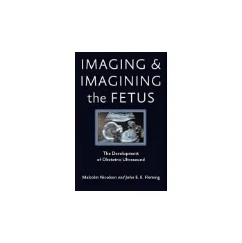 Cizojazyčná kniha Imaging and Imagining the Fetus - Nicolson, Malcolm (Director, University of Glasgow) a Fleming, John E. E.