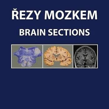 Řezy mozkem: Atlas makroskopických, mikroskopických a MRI řezů Kniha