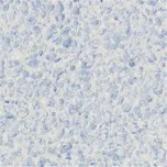 Domoletti D326 tekutá tapeta matně…