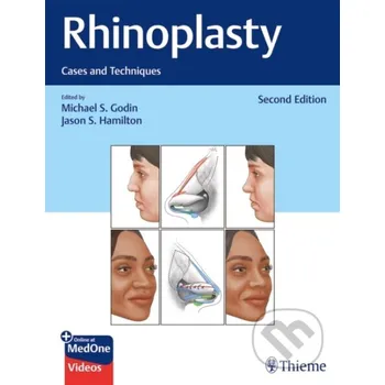 Rhinoplasty - Jason S. Hamilton, Michael S. Godin Thieme Medical Publishers