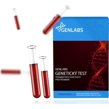 Diagnostický test Trombotest/Faktor II- Protrombin