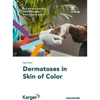 Fast Facts: Dermatoses in Skin of Color - Yesudian, Paul Devakar