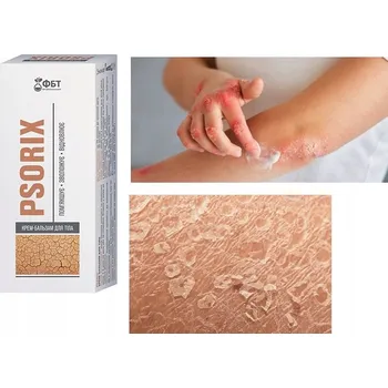 FBT Psorix krém-balzám na tělo lupénka péče AZS Aram 75 ml