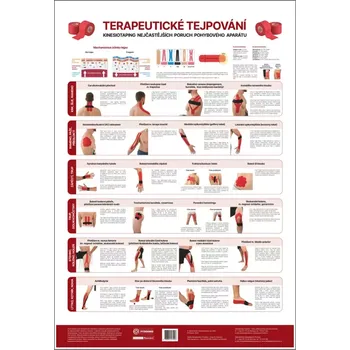 Plakát Plakát Terapeutické tejpování 48x70cm