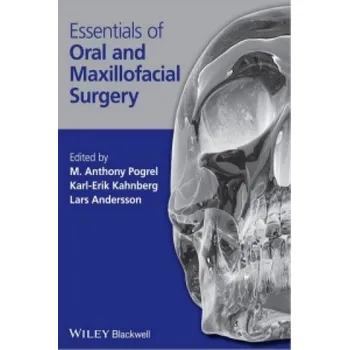 Essentials of Oral and Maxillofacial Surgery – M. Anthony Pogrel (EN)