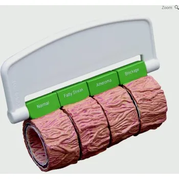 Artérie (4) (nadrozmerné) - s rukoväťou (Anatomické modely)