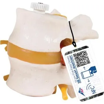 Model dvou lidských bederních obratlů spojených pružně (Anatomické modely)