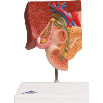 Model žlučových kamenů (Anatomické modely)