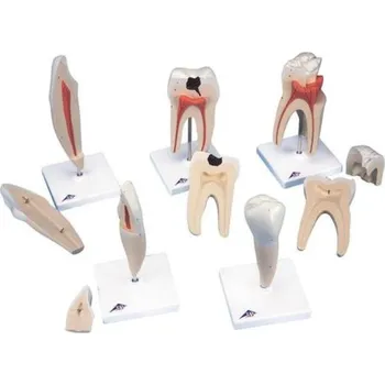 Klasický model zubů, 5 modelů (Anatomické modely)