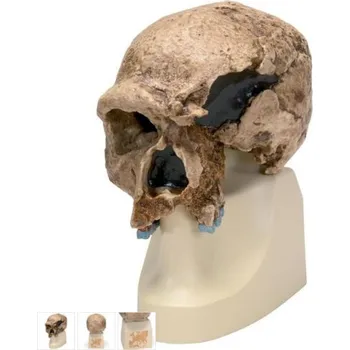 Anthropological Skull Model - Steinheim (Anatomické modely)