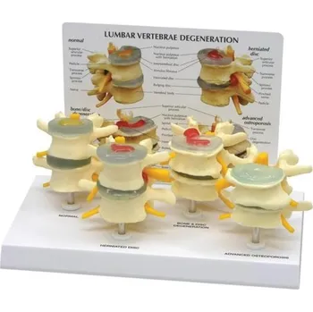 4-stupňový model obratlů (Anatomické modely)