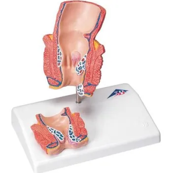 Model hemoroidů (Anatomické modely)