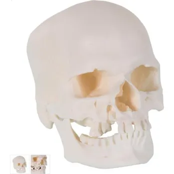 Microcephalic Human Skull Model (Anatomické modely)