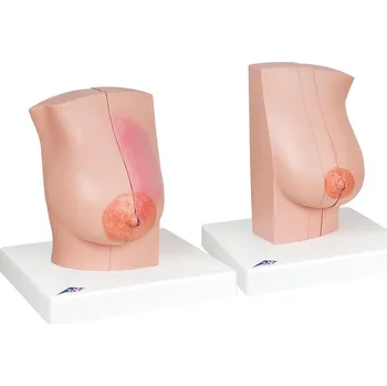 Model ženského prsu (Anatomické modely)