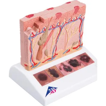 Model rakoviny kůže (Anatomické modely)