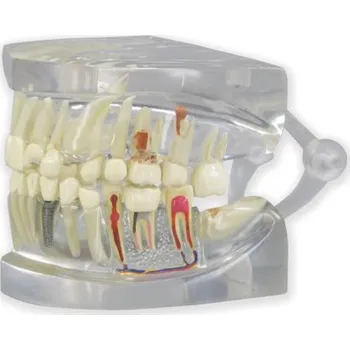Jasný model lidské čelisti se zuby (Anatomické modely)