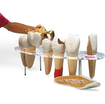 Zubní morfologická série, 7 dílů, 10 krát životní velikost (Anatomické modely)