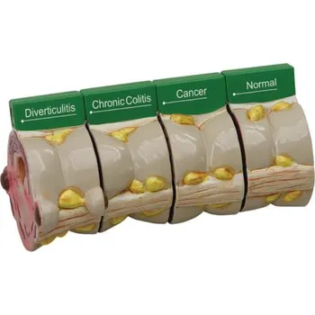 4 kusy s patologií (Anatomické modely)