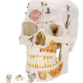 Deluxe Human Demonstration Dental Skull Model, 10 part (Anatomické modely)