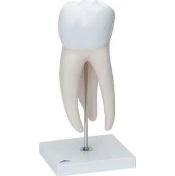 Velká stolička s dentálními dutinami, 15krát životní velikost, 6 dílů (Anatomické modely)