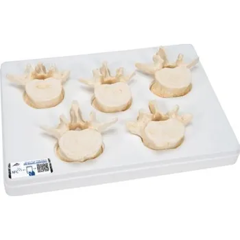 Sada pěti lidských bederních obratlů (Anatomické modely)