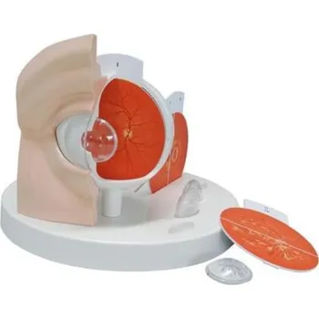 Patologické oko (Anatomické modely)