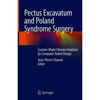 Pectus Excavatum and Poland Syndrome Surgery: Custom-Made Silicone Implants by Computer Aided Design – Jean-Pierre Chavoin (EN)