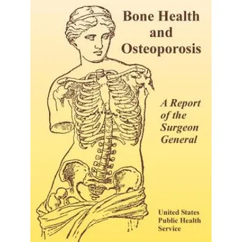 Cizojazyčná kniha Bone Health and Osteoporosis: A Report of the Surgeon General – General Of the United States Surgeon General of the United States (EN)