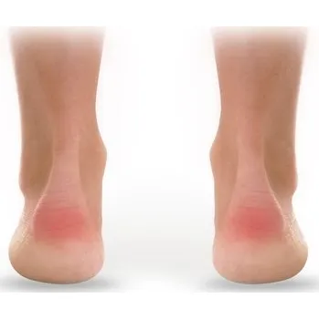 Vložka do bot PATIČKY SAMOLEPICÍ 015 SVORTO