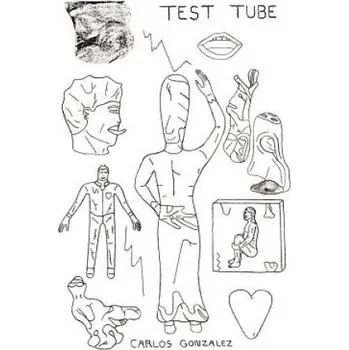 Diagnostický test Test Tube – Carlos Gonzalez (EN)