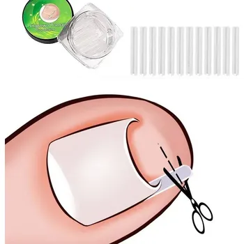 Zdravotnický materiál Náplast na zarůstající nehet | Sada na nehty, Pedikúra 10 ks