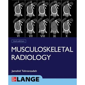 Učebnice Basic Musculoskeletal Imaging, Second Edition (EN)