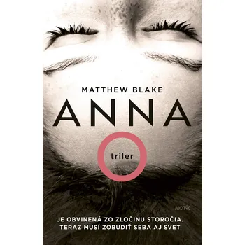 Anna O - Matthew Blake