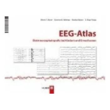 EEG-Atlas: Elektroenzephalografie bei Kindern und Erwachsenen – Warren T. Blume,Giannina M. Holloway,Masako Kaibara,G. Bryan Young (DE)
