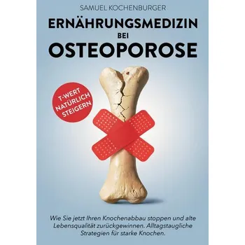 Ernährungsmedizin bei Osteoporose - Kochenburger, Samuel