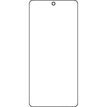 engaroGuard Hydrogel - ochranná fólie - OnePlus 13s průsvitná nepoužívám kryt = folie na celý displej 1 kus s výřezem přední kamery