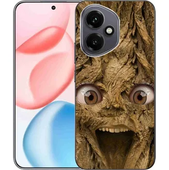 Pouzdro na mobilní telefon Gelový kryt mmCase na Honor 400 - veselý strom s očima