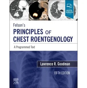 Felson's Principles of Chest Roentgenology, A Programmed Text (Lawrence R Goodman)(Brožovaná)
