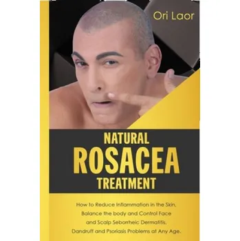 Cizojazyčná kniha Natural Rosacea Treatment: How to Reduce Inflammation in the Skin, Balance the body and Control Face and Scalp Seborrheic Dermatitis, Dandruff an (Ori Laor)(Brožovaná)